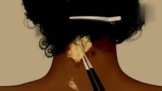 ASMR Hair loss women scalp treatment Animation#treatment#asmr#MasterASMR