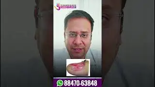 Glomus Tumor Explained | Intense Fingertip Pain? See Dr. Veshal Gautam&rsquo;s Expert Advice!
