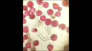 Pollen germination