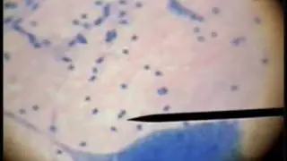 Slide 41 - Giant Mulitpolar Neuron
