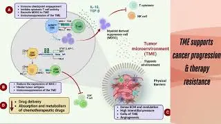 Unraveling the tumor microenvironment: Insights into cancer metastasis and therapeutic strategies