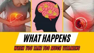 What Happens When You Take Too Many Vitamins | Vitamin Overdose Side Effects