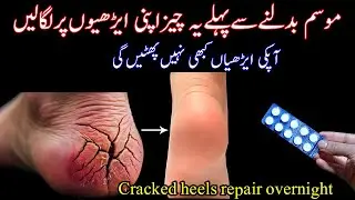 Hands Feet Repair Homemade Cream|DIY Hand And Feet Whitening Remedy|Cracked Heels Repair Remedy