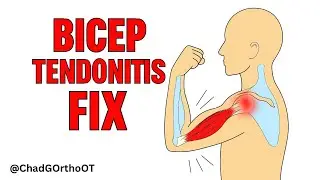 Bicep Tendonitis Rehab Tips 