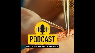 Hair Transplant in India | Live@6  #podcast