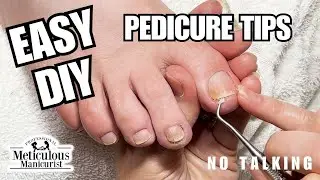 👣Clean Yellow Toenails at Home - No Talking👣