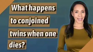What happens to conjoined twins when one dies?