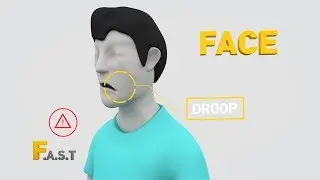 SAFE STEPS First Aid: Stroke