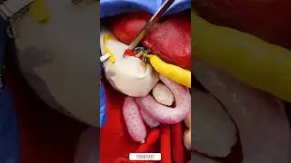 Inside an OR Surgery Simulation #fblifestyle