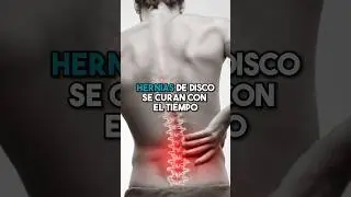 Las hernias de disco se curan con el tiempo ‼️ #fisioterapiatualcance