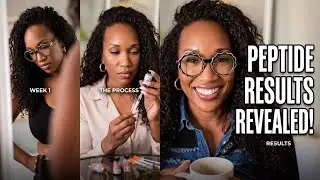 My Anti-Aging Routine at 40+ (The Truth About Peptides)