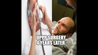 UPPP SURGERY 4 YEARS LATER