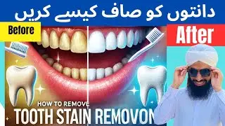 Whiten Teeth in 5 minutes 2025 | Removing Tooth Stains Naturally|Tartar, Plaque@ateeqdentalcare