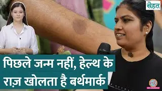 Birthmark यानी जन्म से शरीर पर निशान क्यों होते हैं, इनका क्या मतलब है, डॉक्टर ने बताया | Sehat 1082