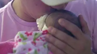 Conjoined Twins at The Children's Hospital at OU Medical Center