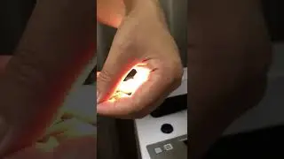 USB endoscope camera for rigid scope support phone and computer