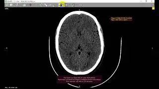 case discussion 3