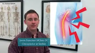 Top 3 Causes Of Sciatica Explained By MSK Expert