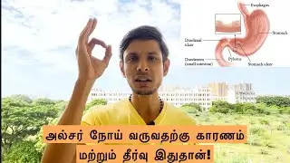 Main reason for ulcers | CAUSE AND CURE | Sundar JC