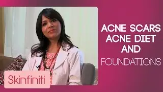 Acne Scars, Acne Diet & Foundations | #AskJaishree | Episode 1 | Skincare