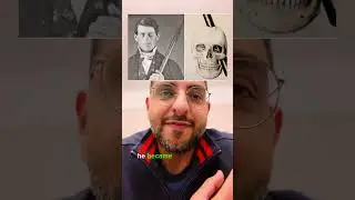 Phineas Gage (FRONTAL LOBE SYNDROME) #brain #mentalhealth #psychiatrist #psychiatry