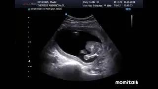 3D Baby Scan Actual Full Version lol