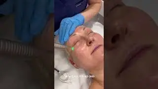 Erase Years in Minutes! Anti-Aging Eye Treatments with Fotona SmoothEye  #fotona4d