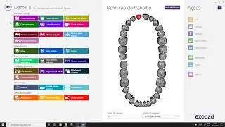 Criando Ordem de Trabalho Coroa Unitária  ( ExoCad )