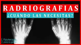 Antes de sacarte Radiografías!! Ve este video 🙄