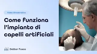 Come funziona l'impianto di capelli artificiali