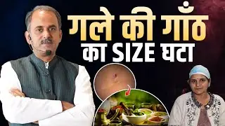 Cyst Treatment without Surgery | Acharya Manish ji | HiiMS