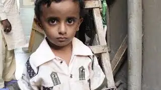 Muhammad Bilal 2nd Surgery's Success Story