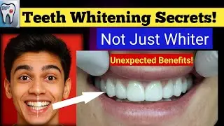 #1 Teeth Cleaning At Home | Teeth Saaf Karne Ka Tarika | Tartar Removal|Teeth Whitening At Dentist