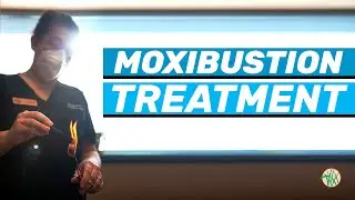 Moxibustion Treatment