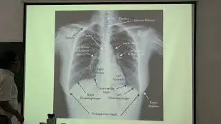 SGD On How to Read X-Rays: A Beginner's Guide to Chest & Upper Limb Interpretation | MBBS