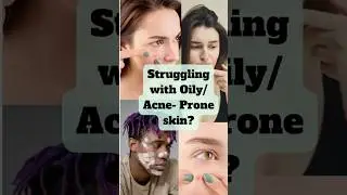 Oily, Acne-Prone skin? Try this game-changing skincare pairing! #skincaretips #clearskingoals #skin