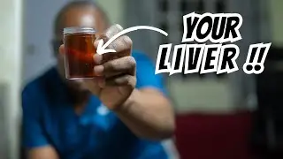 What your Urine says about your Health