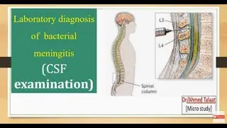 Laboratory diagnosis of bacterial meningitis (CSF Examination)