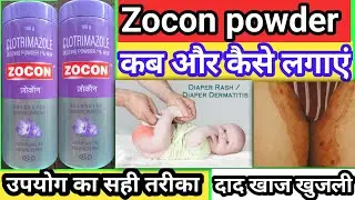 Zocon powder ke fayde | zocon powder uses in hindi | uses of zocon powder | zocon dusting powder use
