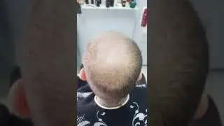 Applicazione protesi capelli