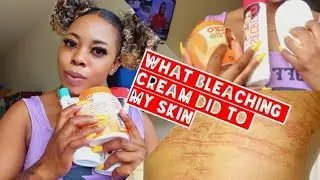DODO WHITE UP/WHITE SECRET LOTION REVIEW +WHAT BLEACHING CREAM DID TO MY SKIN😭😭😭😭
