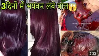 1 बार इसे लगाकर देखो 3 दिनों में बालों को लंबा घना और जड़ से मजबूत बना देगा #longhairgrowthtips 