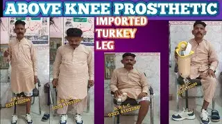 ABOVE KNEE prosthetic Artificial leg  TURKISH+CHINA #ottobock #limb #leg #prosthesis #viral #duet