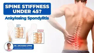 Ankylosing Spondylitis | Symptoms, Diagnosis and Treatment | Dr Archana Uppin