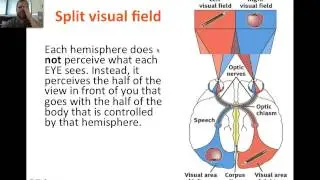 Split Brain