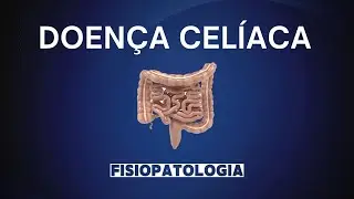 Doença Celíaca - Parte 1