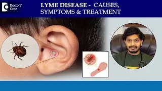 What is Lyme Disease? Tick Bite Rash | Bull's Eye Rash Treatment-Dr.Leela Mohan PVR |Doctors' Circle