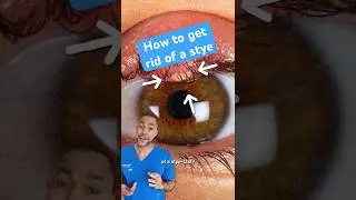 How to get rid of a stye