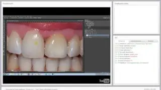 2016 02 02  Компьютерное моделирование   мастер класс   1 этап  Digital smile design по русски  6730