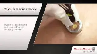 Laser hair removal for all skin types.The safest and most complete aesthetic platform.